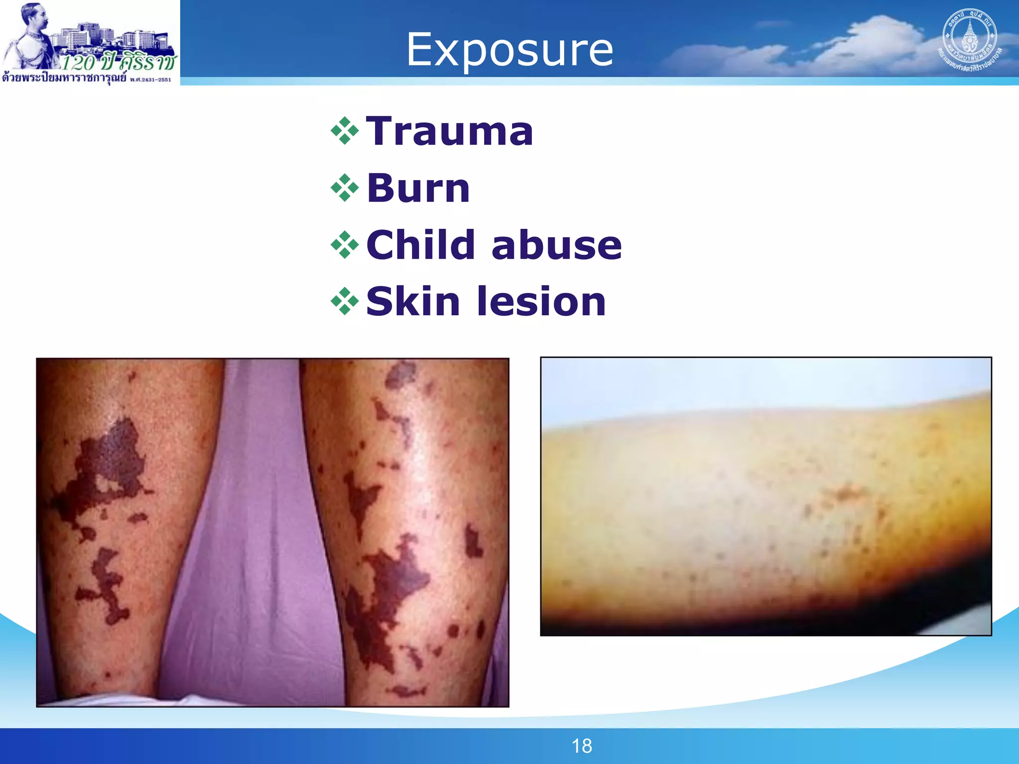 Exposure
Trauma
Burn
Child abuse
Skin lesion




         18
 