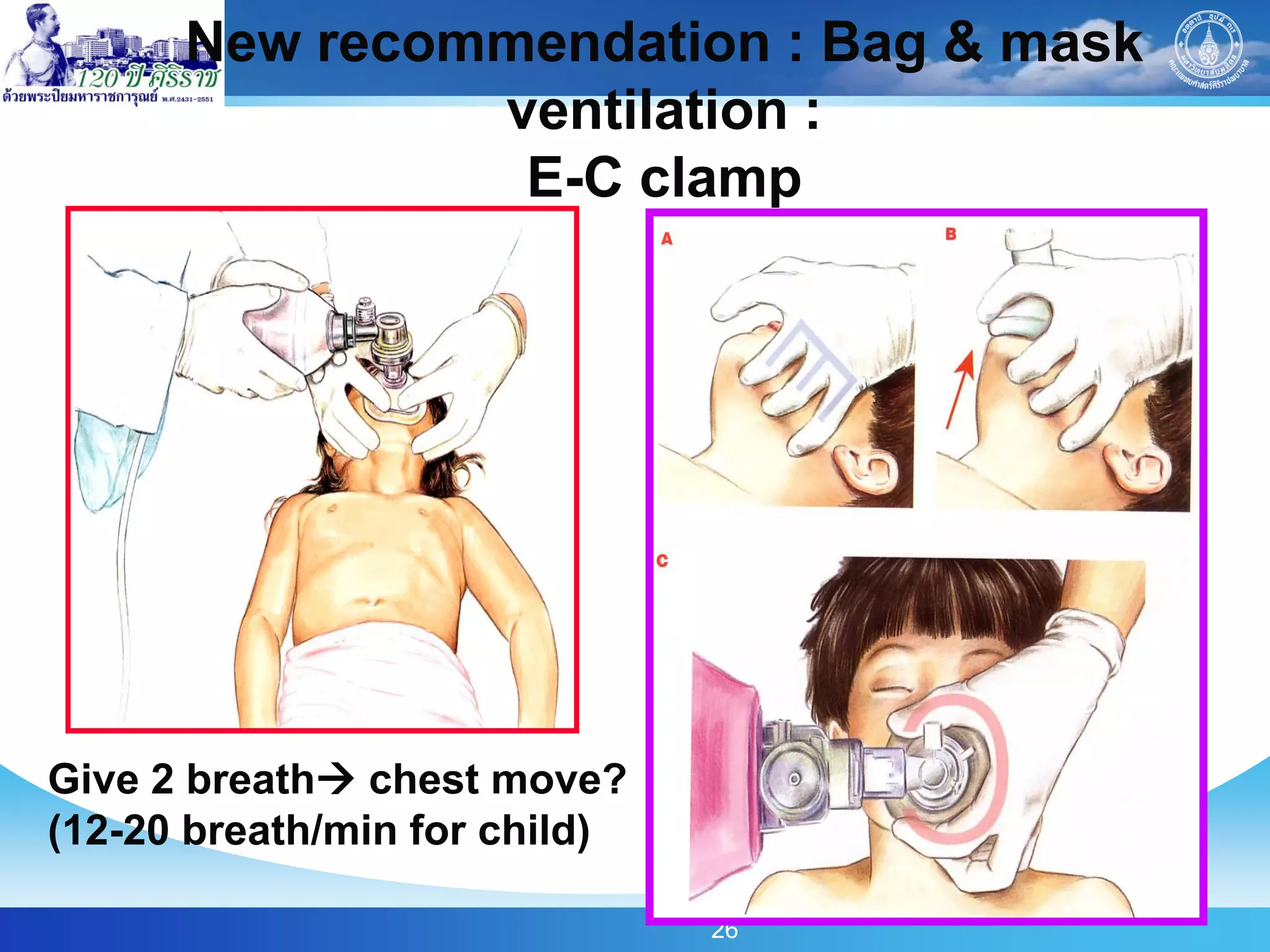 New recommendation : Bag & mask
               ventilation :
                E-C clamp




Give 2 breath chest move?
(12-20 breath/min for child)

                               26
 