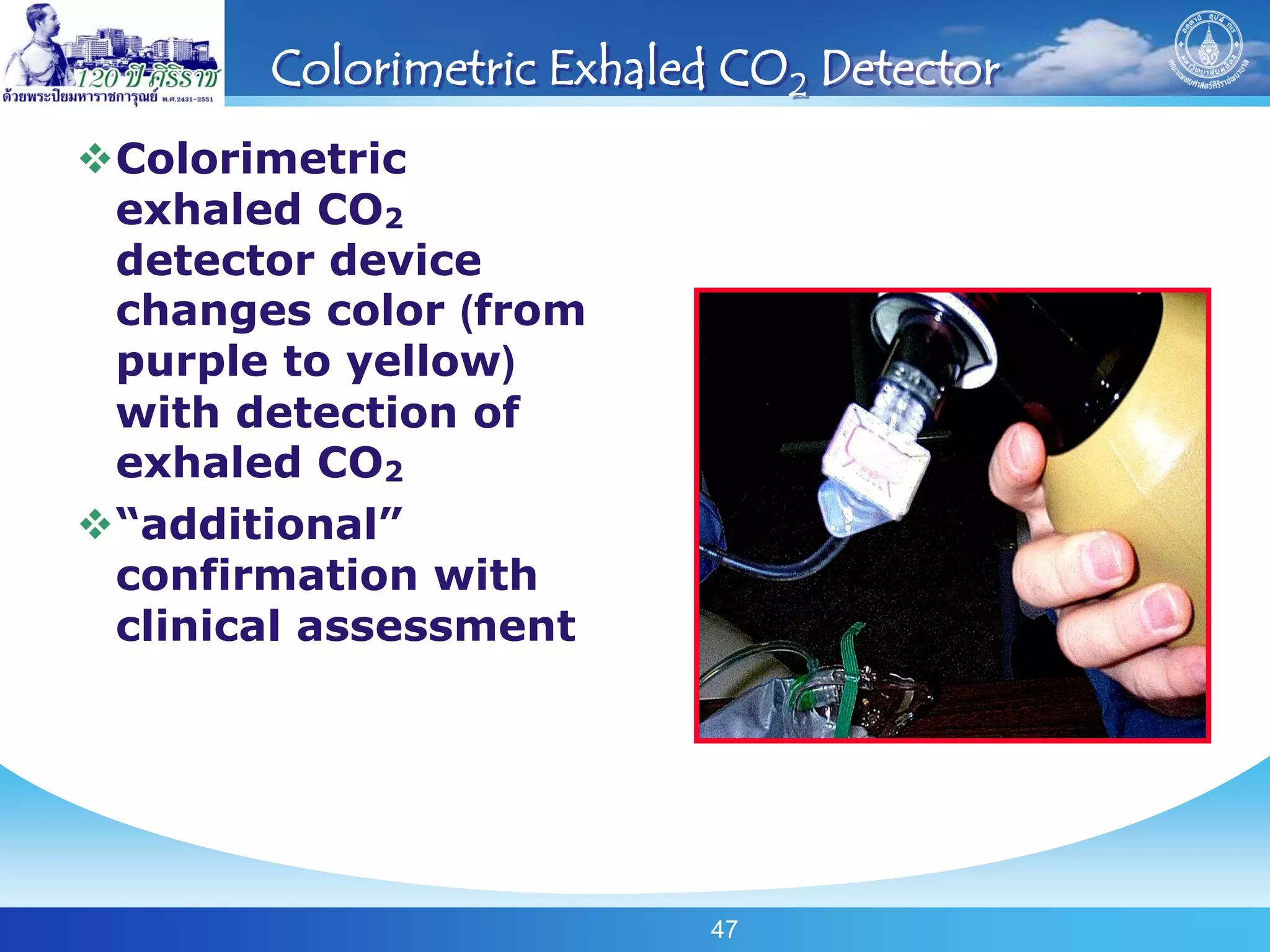 Colorimetric Exhaled CO2 Detector
Colorimetric
 exhaled CO2
 detector device
 changes color (from
 purple to yellow)
 with detection of
 exhaled CO2
“additional”
 confirmation with
 clinical assessment




                          47
 