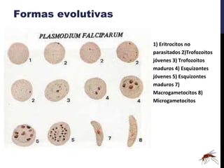 Formas evolutivas 1) Eritrocitos no parasitados  2)Trofozoitos jóvenes  3) Trofozoitos maduros  4) Esquizontes jóvenes  5) Esquizontes maduros  7) Macrogametocitos  8) Microgametocitos 