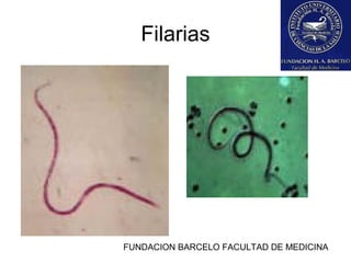 FUNDACION BARCELO FACULTAD DE MEDICINA
Filarias
 