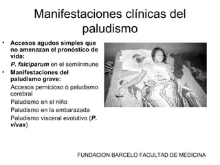 FUNDACION BARCELO FACULTAD DE MEDICINA
Manifestaciones clínicas del
paludismo
• Accesos agudos simples que
no amenazan el pronóstico de
vida:
P. falciparum en el semiinmune
• Manifestaciones del
paludismo grave:
Accesos pernicioso ó paludismo
cerebral
Paludismo en el niño
Paludismo en la embarazada
Paludismo visceral evolutivo (P.
vivax)
 