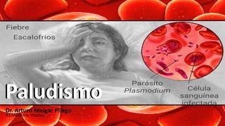 Paludismo
Dr. Arturo Melgar Pliego
R3 Medicina Interna
Paludismo
 