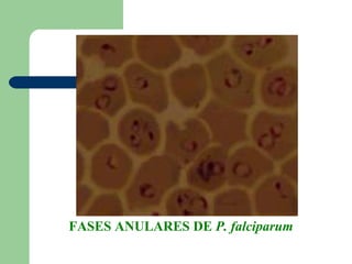 FASES ANULARES DE P. falciparum
 