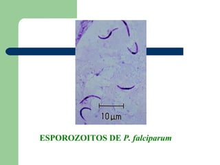 ESPOROZOITOS DE P. falciparum
 