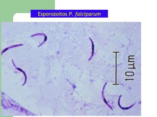 Esporozoítos P. falciparum
 