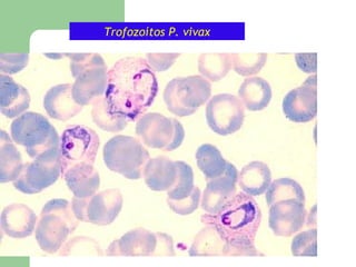 Trofozoítos P. vivax
 