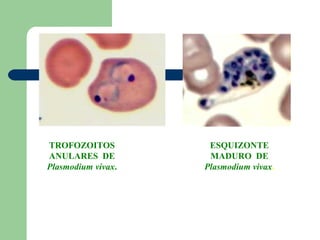 TROFOZOITOS          ESQUIZONTE
ANULARES DE          MADURO DE
Plasmodium vivax.   Plasmodium vivax.
 