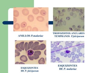 TROFOZOITOS ANULARES
ANILLOS P.malariae    TEMPRANOS P.falciparum




                        ESQUIZONTES
 ESQUIZONTES             DE P. malariae
 DE P. falciparum
 