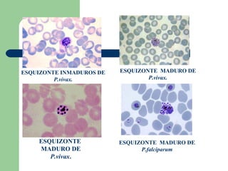 ESQUIZONTE INMADUROS DE   ESQUIZONTE MADURO DE
         P.vivax.                 P.vivax.




    ESQUIZONTE            ESQUIZONTE MADURO DE
    MADURO DE                   P.falciparum
       P.vivax.
 