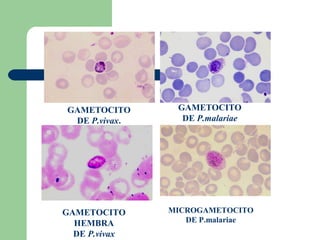 GAMETOCITO      GAMETOCITO
 DE P.vivax.     DE P.malariae




GAMETOCITO     MICROGAMETOCITO
  HEMBRA          DE P.malariae
  DE P.vivax
 