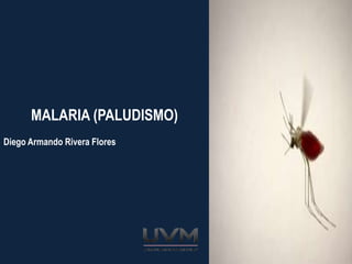 MALARIA (PALUDISMO)
Diego Armando Rivera Flores
 