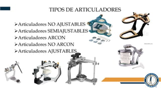 TIPOS DE ARTICULADORES
Articuladores NO AJUSTABLES
Articuladores SEMIAJUSTABLES
Articuladores ARCON
Articuladores NO ARCON
Articuladores AJUSTABLES
 