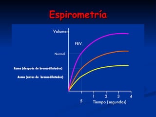 Espirometría 1 2 3 4 5 Tiempo (segundos) FEV 1 Volumen Normal   Asma (después de broncodilatador) Asma (antes de  broncodilatador) 