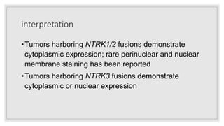 interpretation
•Tumors harboring NTRK1/2 fusions demonstrate
cytoplasmic expression; rare perinuclear and nuclear
membrane staining has been reported
•Tumors harboring NTRK3 fusions demonstrate
cytoplasmic or nuclear expression
 
