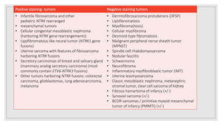 Negative staining tumorsPositive staining- tumors
• Dermtofibrosarcoma protuberans (DFSP)
• Lipofibromatosis
• Myofibroma(tosis)
• Cellular myofibroma
• Desmoid-type fibromatosis
• Malignant peripheral nerve sheath tumor
(MPNST)
• Spindle cell rhabdomyosarcoma
• Nodular fasciitis
• Schwannoma
• Neurofibroma
• Inflammatory myofibroblastic tumor (IMT)
• Uterine leiomyosarcoma
• Classic mesoblastic nephroma, metanephric
stromal tumor, clear cell sarcoma of kidney
• Fibrous hamartoma of infancy (+/-)
• Synovial sarcoma (+/-)
• BCOR-sarcomas / primitive myxoid mesenchymal
tumor of infancy (PMMTI) (+/-)
• Infantile fibrosarcoma and other
pediatric NTRK rearranged
• mesenchymal tumors
• Cellular congenital mesoblastic nephroma
(harboring NTRK gene rearrangements)
• Lipofibromatous-like neural tumor (NTRK1 gene
fusions)
• Uterine sarcoma with features of fibrosarcoma
harboring NTRK fusions
• Secretory carcinomas of breast and salivary gland
(mammary analog secretory carcinoma) (most
commonly contain ETV6-NTRK3 fusions)
• Other tumors harboring NTRK fusions: colorectal
carcinoma, glioblastomas, lung adenocarcinoma,
melanoma
 