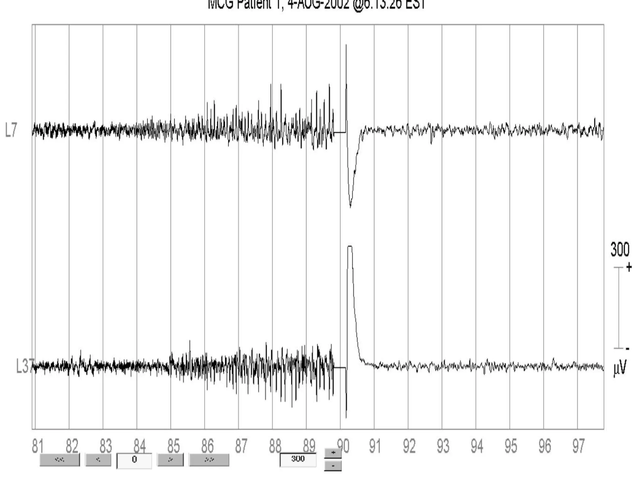 Anthony Murro, M.D. Medical College of Georgia 
