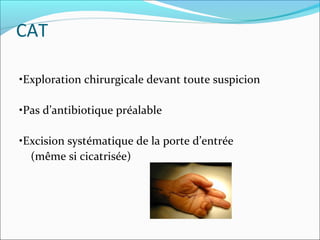 CAT
•Exploration chirurgicale devant toute suspicion
•Pas d’antibiotique préalable
•Excision systématique de la porte d’entrée
(même si cicatrisée)
 