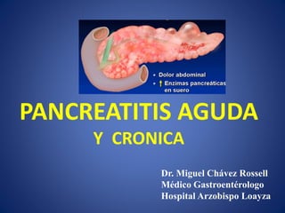PANCREATITIS AGUDA Y CRONICA 
Dr. Miguel Chávez Rossell 
Médico Gastroentérologo 
Hospital Arzobispo Loayza 
 