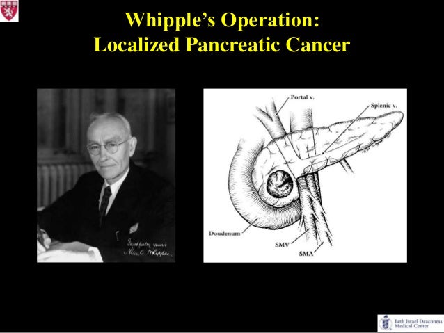 Innovations in Pancreatic Cancer A Reason to Hope