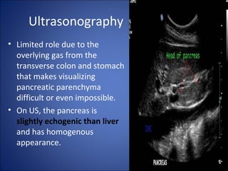 Ultrasonography
• Limited role due to the
overlying gas from the
transverse colon and stomach
that makes visualizing
pancreatic parenchyma
difficult or even impossible.
• On US, the pancreas is
slightly echogenic than liver
and has homogenous
appearance.
 