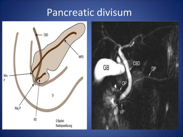 Pancreas | PPT
