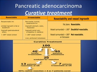 Pancreatic adenocarcinoma
Curative treatment
 