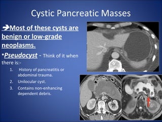 Cystic Pancreatic Masses
Most of these cysts are
benign or low-grade
neoplasms.
•Pseudocyst - Think of it when
there is:-
1. History of pancreatitis or
abdominal trauma.
2. Unilocular cyst.
3. Contains non-enhancing
dependent debris.
 