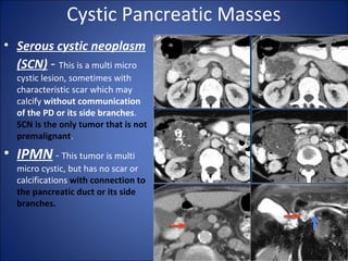 Cystic Pancreatic Masses
• Serous cystic neoplasm
(SCN) - This is a multi micro
cystic lesion, sometimes with
characteristic scar which may
calcify without communication
of the PD or its side branches.
SCN is the only tumor that is not
premalignant.
• IPMN - This tumor is multi
micro cystic, but has no scar or
calcifications with connection to
the pancreatic duct or its side
branches.
 
