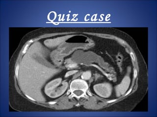 Quiz case
 