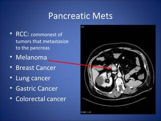 Pancreatic Mets
• RCC: commonest of
tumors that metastasize
to the pancreas
• Melanoma
• Breast Cancer
• Lung cancer
• Gastric Cancer
• Colorectal cancer
 