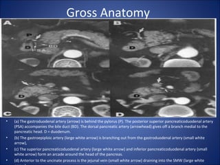 Gross Anatomy
• (a) The gastroduodenal artery (arrow) is behind the pylorus (P). The posterior superior pancreaticoduodenal artery
(PSA) accompanies the bile duct (BD). The dorsal pancreatic artery (arrowhead) gives off a branch medial to the
pancreatic head. D = duodenum.
• (b) The gastroepiploic artery (large white arrow) is branching out from the gastroduodenal artery (small white
arrow),
• (c) The superior pancreaticoduodenal artery (large white arrow) and inferior pancreaticoduodenal artery (small
white arrow) form an arcade around the head of the pancreas.
• (d) Anterior to the uncinate process is the jejunal vein (small white arrow) draining into the SMW (large white
 