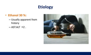 • Ethanol 30 %:
– Usually apparent from
history
– AST:ALT <2 .
Etiology
 