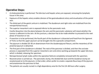 Operative Steps:
• A cholecystectomy is performed. The bile duct and hepatic artery are exposed, removing the lymphatic
tissue in this area.
• Exposure of the hepatic artery enables division of the gastroduodenal artery and visualisation of the portal
vein.
• The distal part of the gastric antrum is mobilised. The duodenum and right colon are mobilised from the
retroperitoneal tissues.
• The superior mesenteric vein is exposed inferior to the pancreatic neck.
• Careful dissection into the plane between the vein and the pancreatic substance will reveal whether the
tumour is adherent to the vein. At this juncture, a decision has to be made whether to proceed to the next
phase of resection or not.
• If resection is to be performed, the fourth part of the duodenum is dissected and freed from the ligament
of Treitz so that the upper jejunum can be brought into the supracolic compartment.
• The jejunum is divided 20–30 cm downstream from the duodenojejunal flexure, and the mesentery of the
proximal jejunum is detached.
• The first part of the duodenum is divided. The neck of the pancreas is divided, and then the uncinate
process is separated from the superior mesenteric vein and artery working up towards the upper bile duct,
which is divided, releasing the specimen.
• Retroperitoneal lymph nodes within the operative field are completely removed with the specimen.
• Reconstruction is carried out . The pancreatic stump, the divided bile duct and the duodenal stump are
anastomosed on to the jejunum, in that order; others prefer to create a separate Roux loop of the jejunum
and anastomose the pancreas to that.
• The patients are usually nursed in a high-dependency area for the first 24–48 hours after surgery.
 