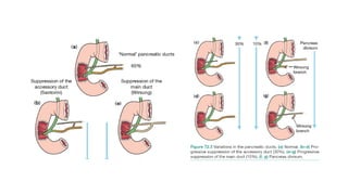 Pancreas anatomy physiology surgery and carcinoma related | PPTX