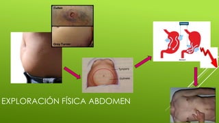 EXPLORACIÓN FÍSICA ABDOMEN
 