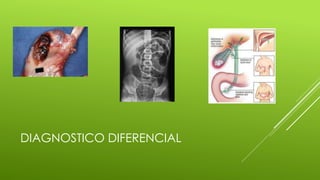 DIAGNOSTICO DIFERENCIAL
 