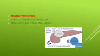  ABSCESO PANCREATICO
 A PARECE POSTERIOR A VARIOS DIAS.
 DRENAJE EXTERNO COMO TRATAMIENTO.
 