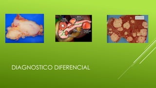 DIAGNOSTICO DIFERENCIAL
 