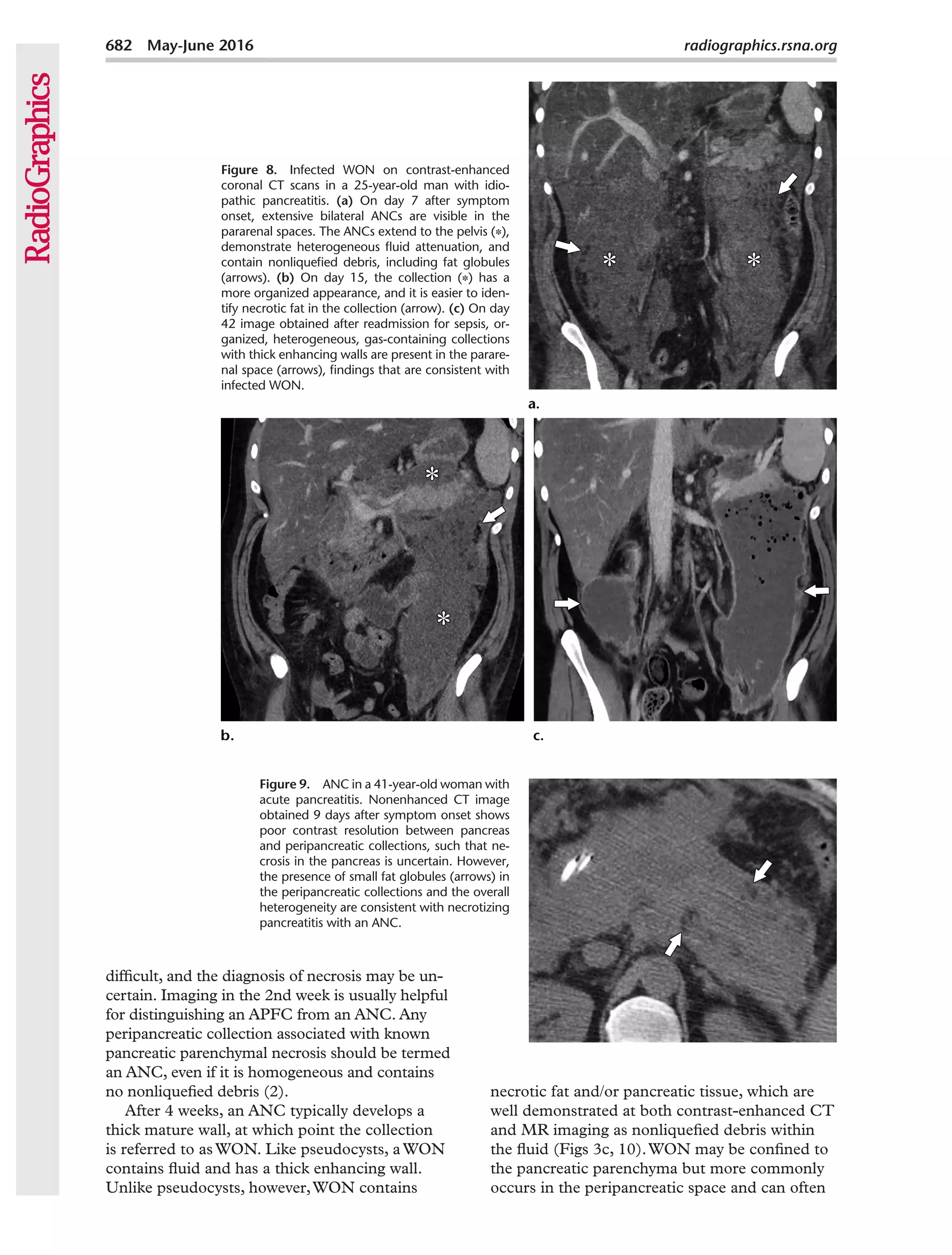 pancreas 3.pdf