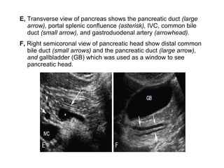 Pancreas ultrasound | PPT
