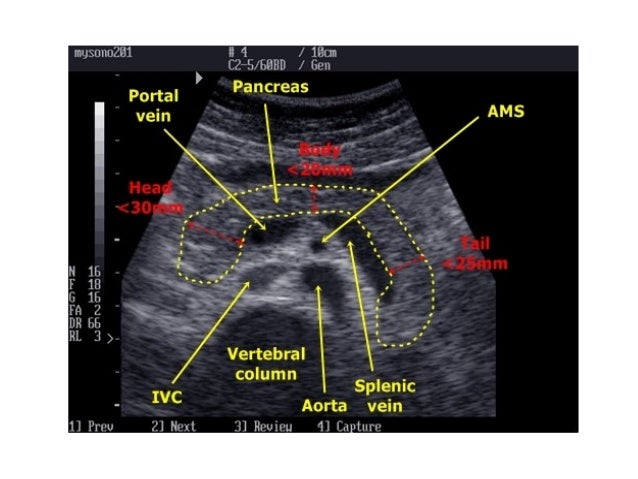 Pancreas ultrasound