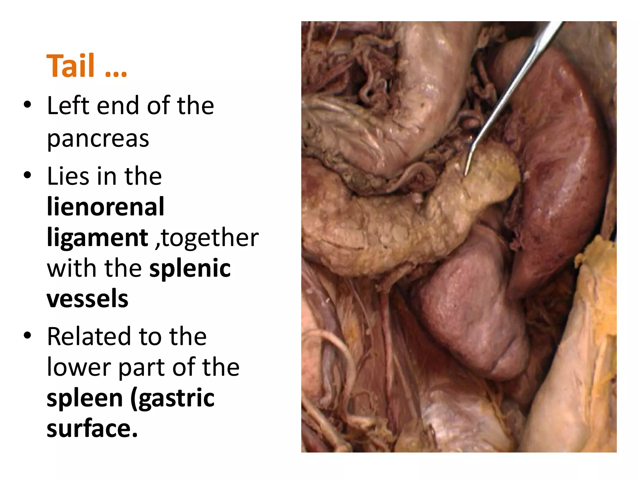 Tail …
• Left end of the
pancreas
• Lies in the
lienorenal
ligament ,together
with the splenic
vessels
• Related to the
lower part of the
spleen (gastric
surface.
 