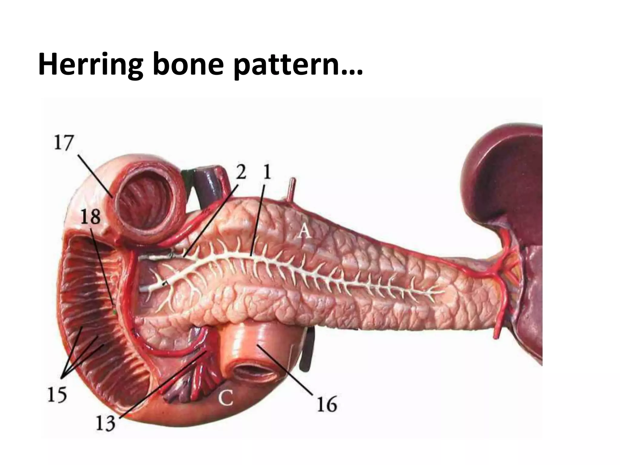 Herring bone pattern…
 