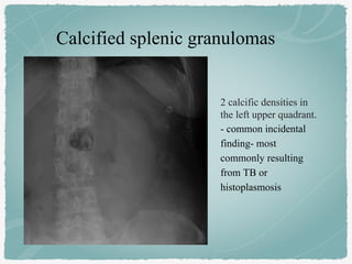 Calcified splenic granulomas
2 calcific densities in
the left upper quadrant.
- common incidental
finding- most
commonly resulting
from TB or
histoplasmosis
 