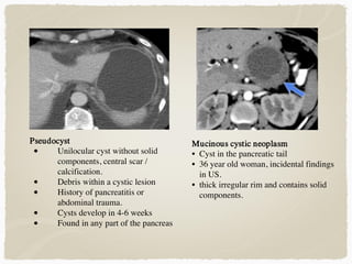 Mucinous cystic neoplasm
• Cyst in the pancreatic tail
• 36 year old woman, incidental findings
in US.
• thick irregular rim and contains solid
components.
Pseudocyst
• Unilocular cyst without solid
components, central scar /
calcification.
• Debris within a cystic lesion
• History of pancreatitis or
abdominal trauma.
• Cysts develop in 4-6 weeks
• Found in any part of the pancreas
 