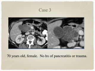 70 years old, female. No hx of pancreatitis or trauma.
 