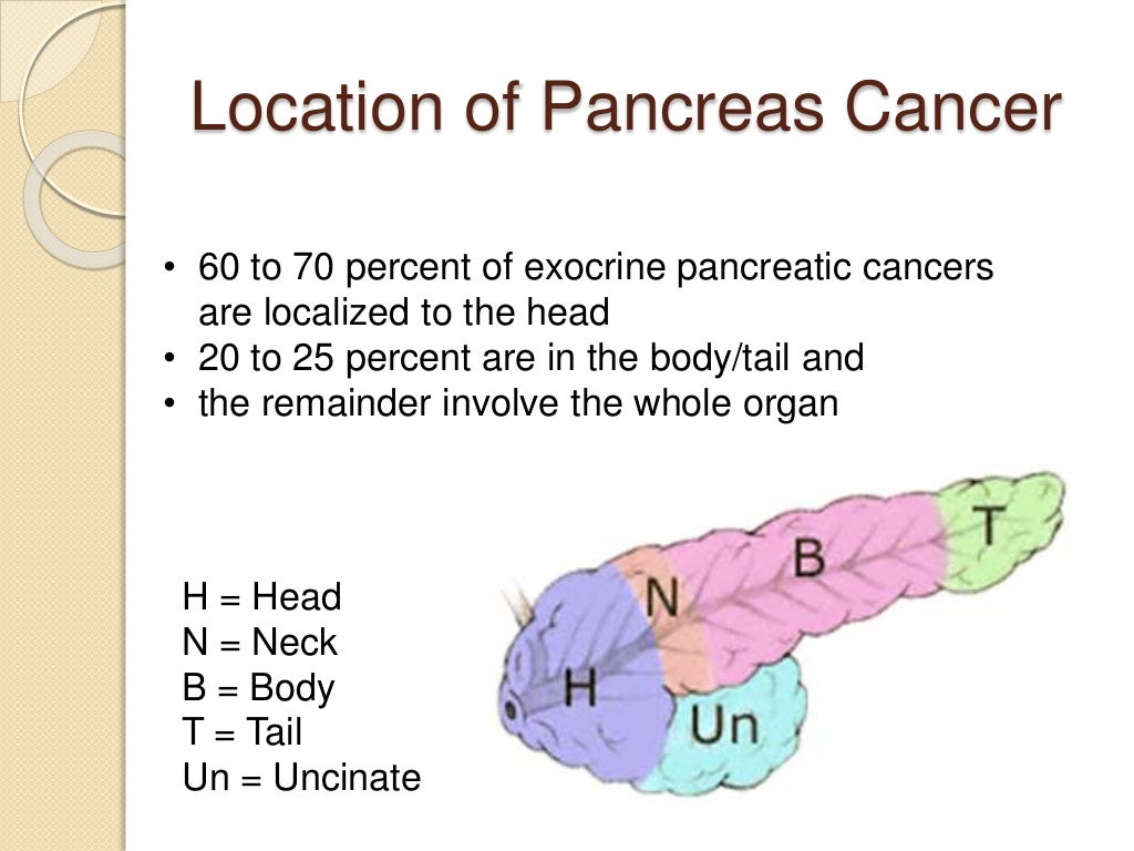 Pancreas Cancer