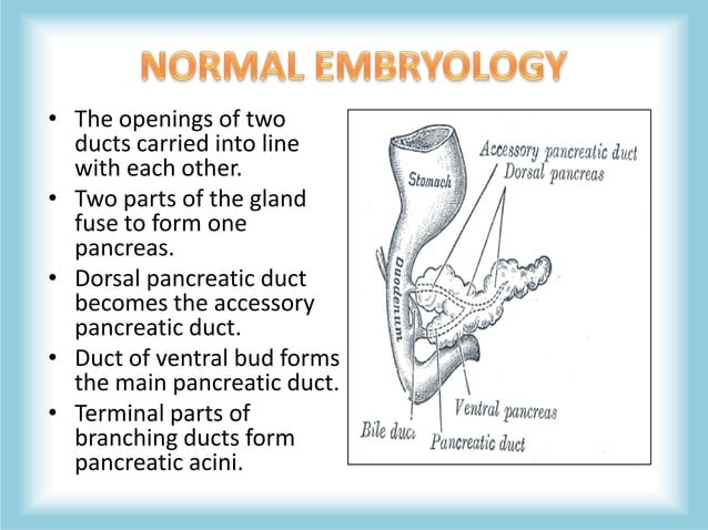 Pancreas Congenital Anomalies (agenesis, pancreas divisum, annular ...