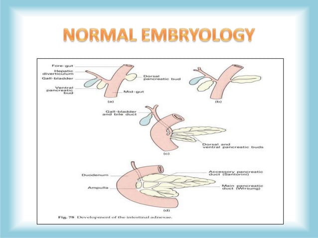 Pancreas Congenital Anomalies (agenesis, pancreas divisum, annular ...